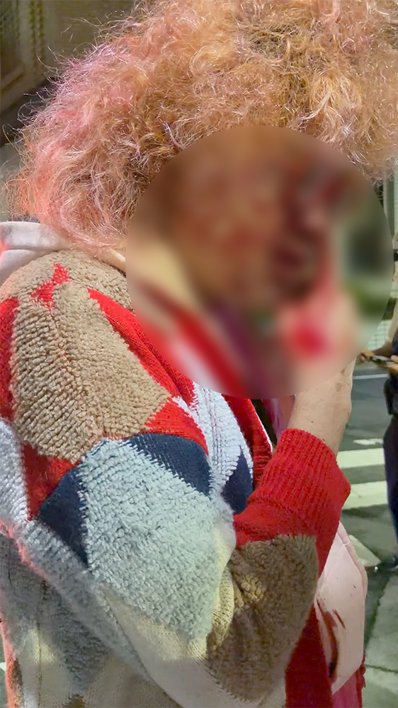 流血する野田草履氏